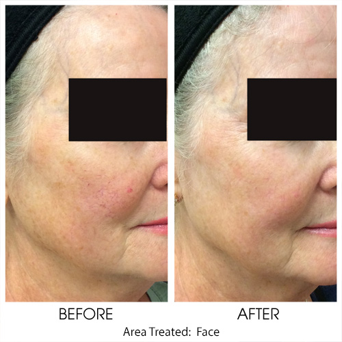 Before + After Gallery: Face