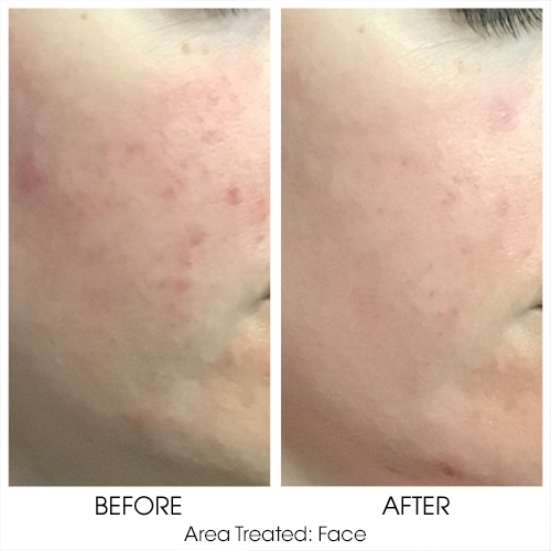 Before + After Gallery: Face