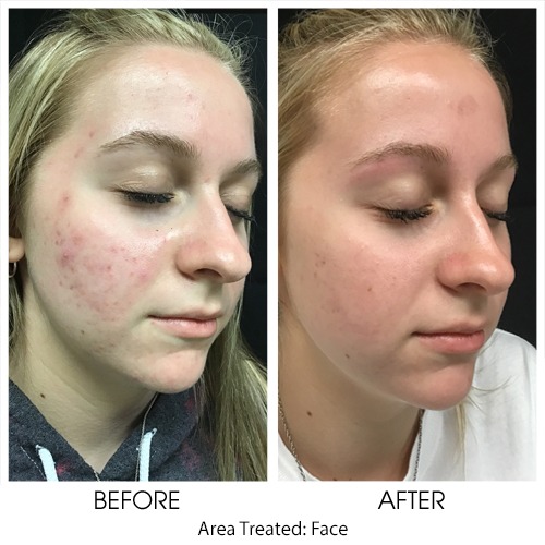 Before + After Gallery: Face