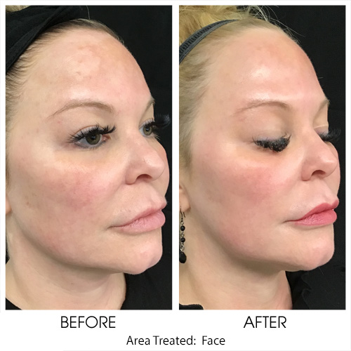 Before + After Gallery: Face