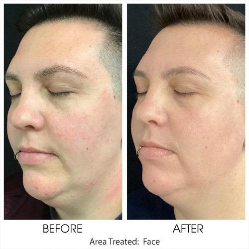 Before + After Gallery: Face