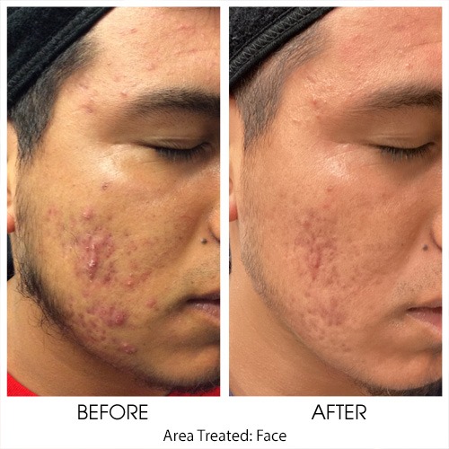Before + After Gallery: Face
