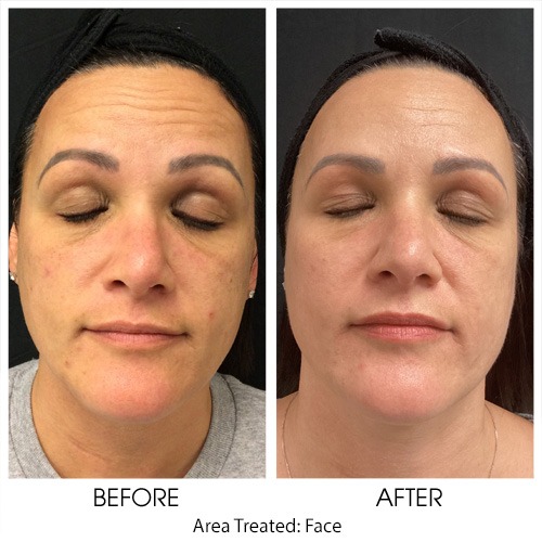 Before + After Gallery: Face