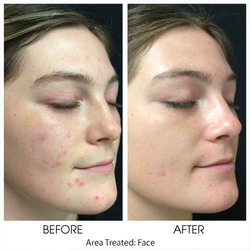 Before + After Gallery: Face