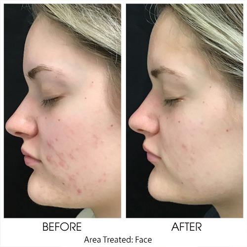 Before + After Gallery: Face