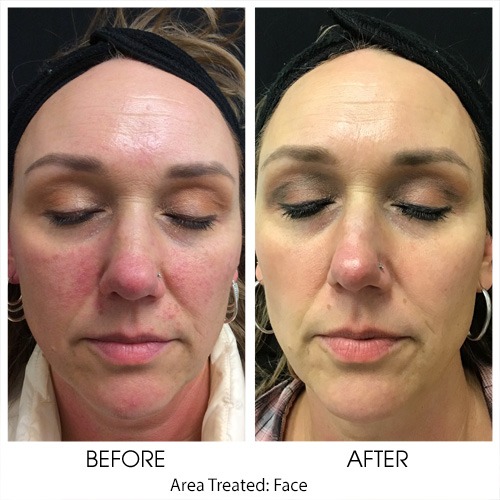 Before + After Gallery: Face