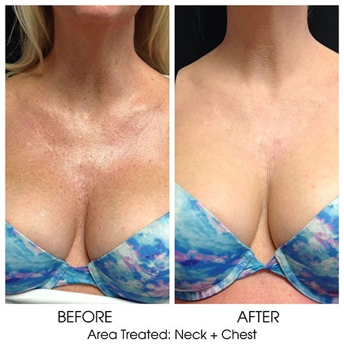 Before + After Gallery: Face