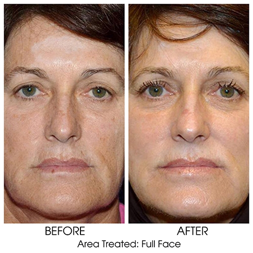 Before + After Gallery: Face