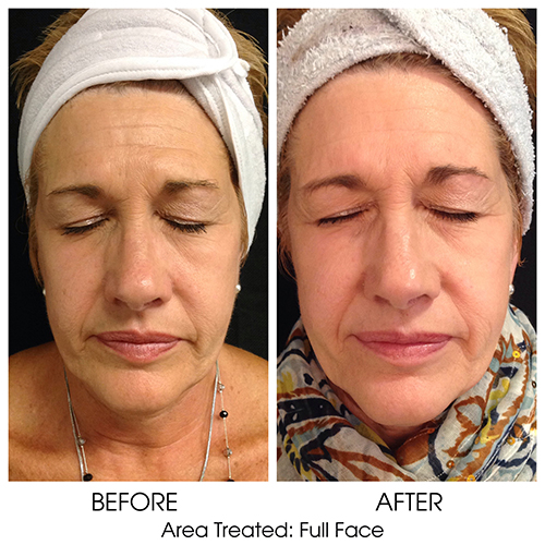 Before + After Gallery: Face