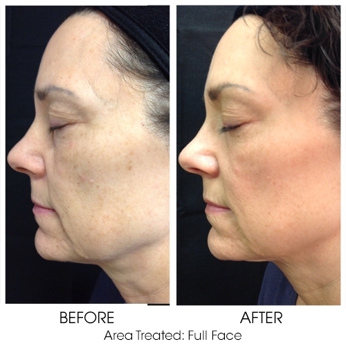 Before + After Gallery: Face