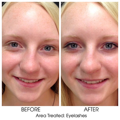 Before + After Gallery: Face