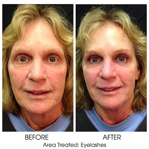 Before + After Gallery: Face