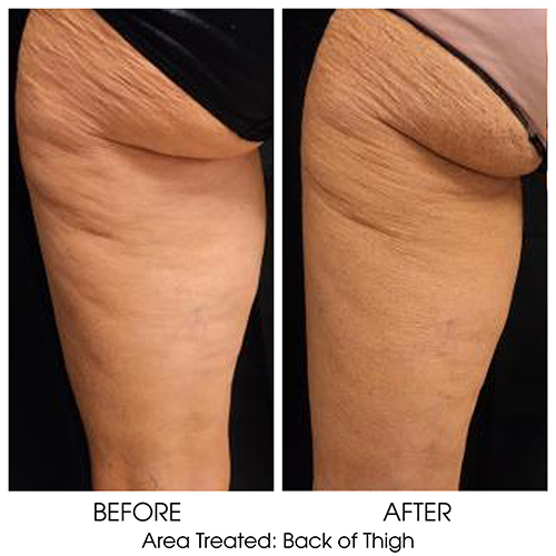 Before + After Gallery: Body