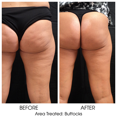 Before + After Gallery: Body