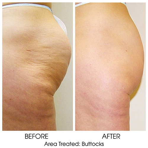 Before + After Gallery: Body